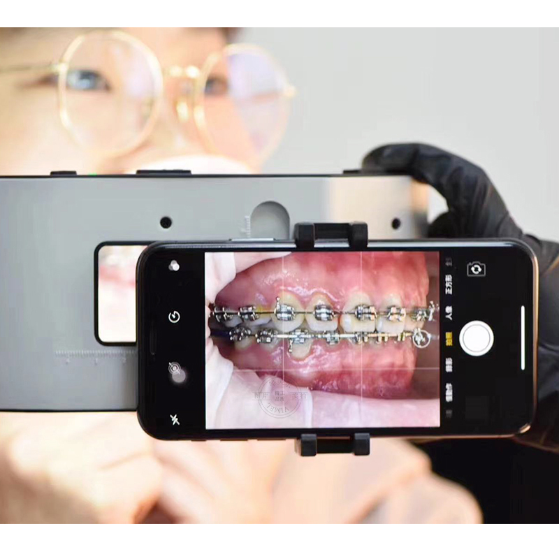 New Dental Flash Light  with H - Photography Equipment recension och pris