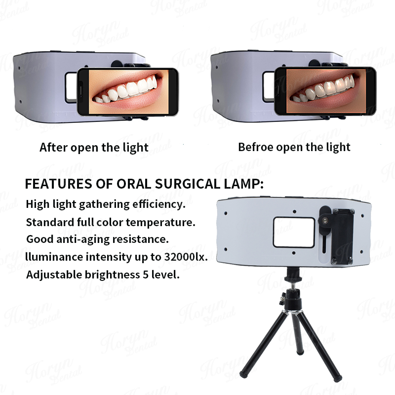 Dental Flash Light Photography - Photography Equipment recension och pris